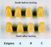 Photo of teeth.