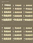 Mold Chart.